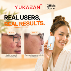 Yukazan Derma Refining Cream Acne & Pore 5ml Acne Removal Cream - Reduce acne in 7 days