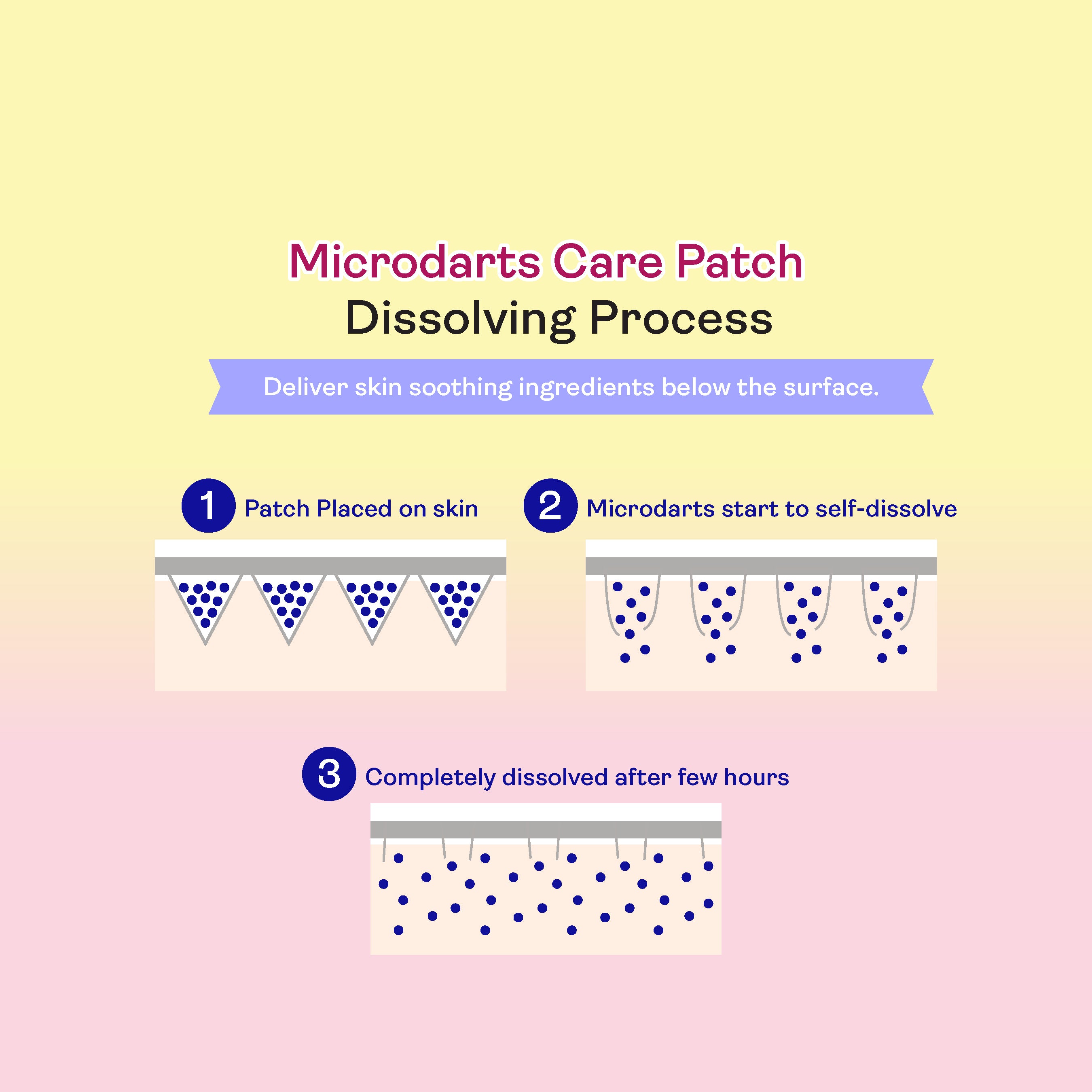 【Yukazan x Butterbear】Microdarts Acne Care Patch 9s | Microneedle Patches for Blind Pimples | Pure Hydrocolloid Skincare